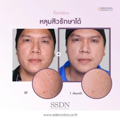 ชุติมา อัศนีรดากร Chutima Atsaniradakorn Edencolors Review Img.22